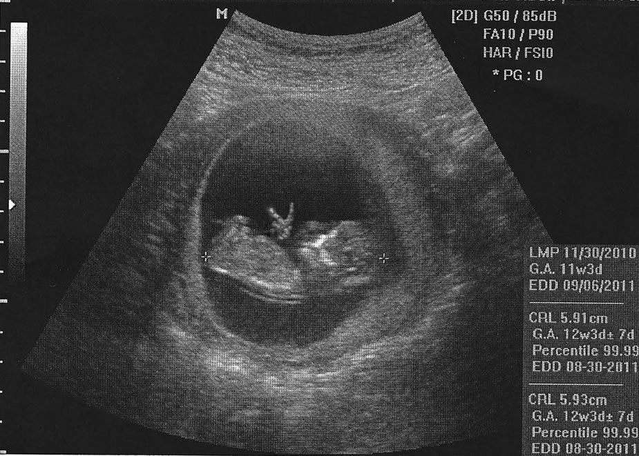 wpid-april_fools_funny_ultrasound-2011-04-1-00-111.jpg